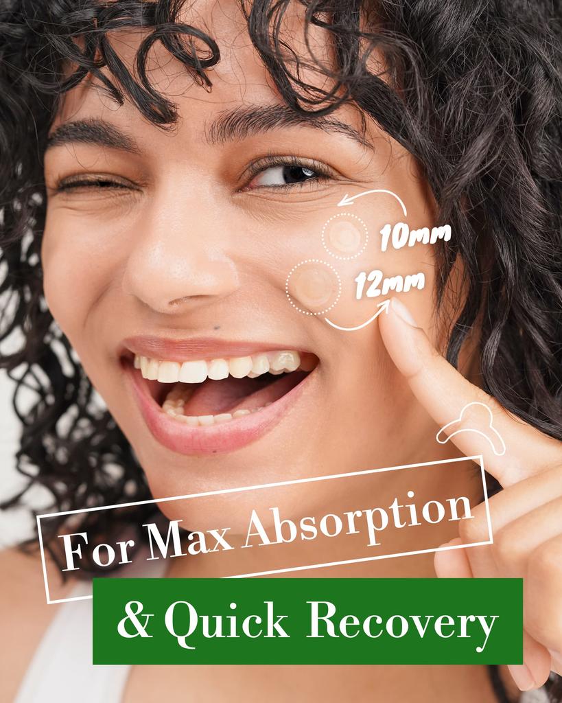 Troubles Invisible Dot Patches The Signature Hydrocolloid Dot Patches for Face Thin Protection Patches with Easy Peel Handle Overnight Dot Patches 2