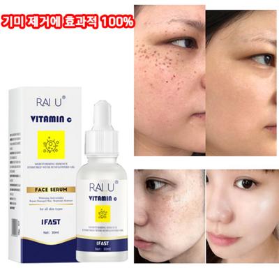 Spot Ampoule Whitening Отбеливающая эссенция Ампула Удаляет веснушки и пигментные пятна, улучшает пигментацию лица, 30 мл, 1 шт.