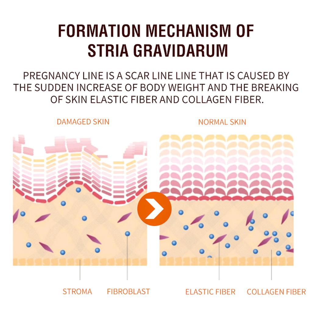 Крем для ухода за кожей Нежный уход Разглаживание кожи Подтягивание кожи Массаж живота Послеродовой крем для ухода за кожей