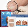Toenail Fungus Patch Nail Repair Patches Nail Ingrown Correction Sticker Discolored Damaged Nails Foot Care Tool Uñas 1/2/3Boxes