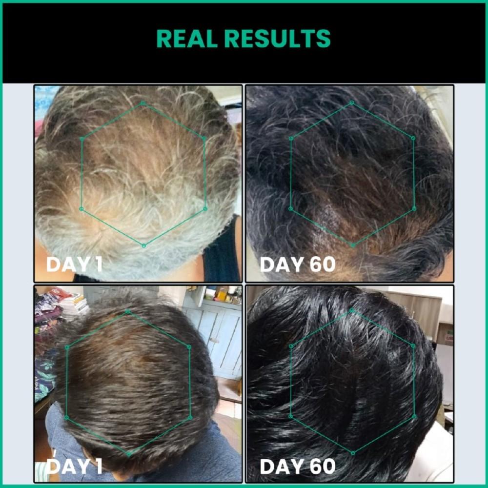 ThriveCo Прайм-сыворотка против седины для волос, 50 ​​мл | Обращает вспять преждевременное поседение