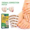 50pcs/Box Ingrown Toenail Sticker Toenail Correction Patch Tools Kit Nail Treatment Foot