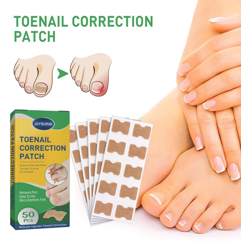 50pcs/Box Ingrown Toenail Sticker Toenail Correction Patch Tools Kit Nail Treatment Foot
