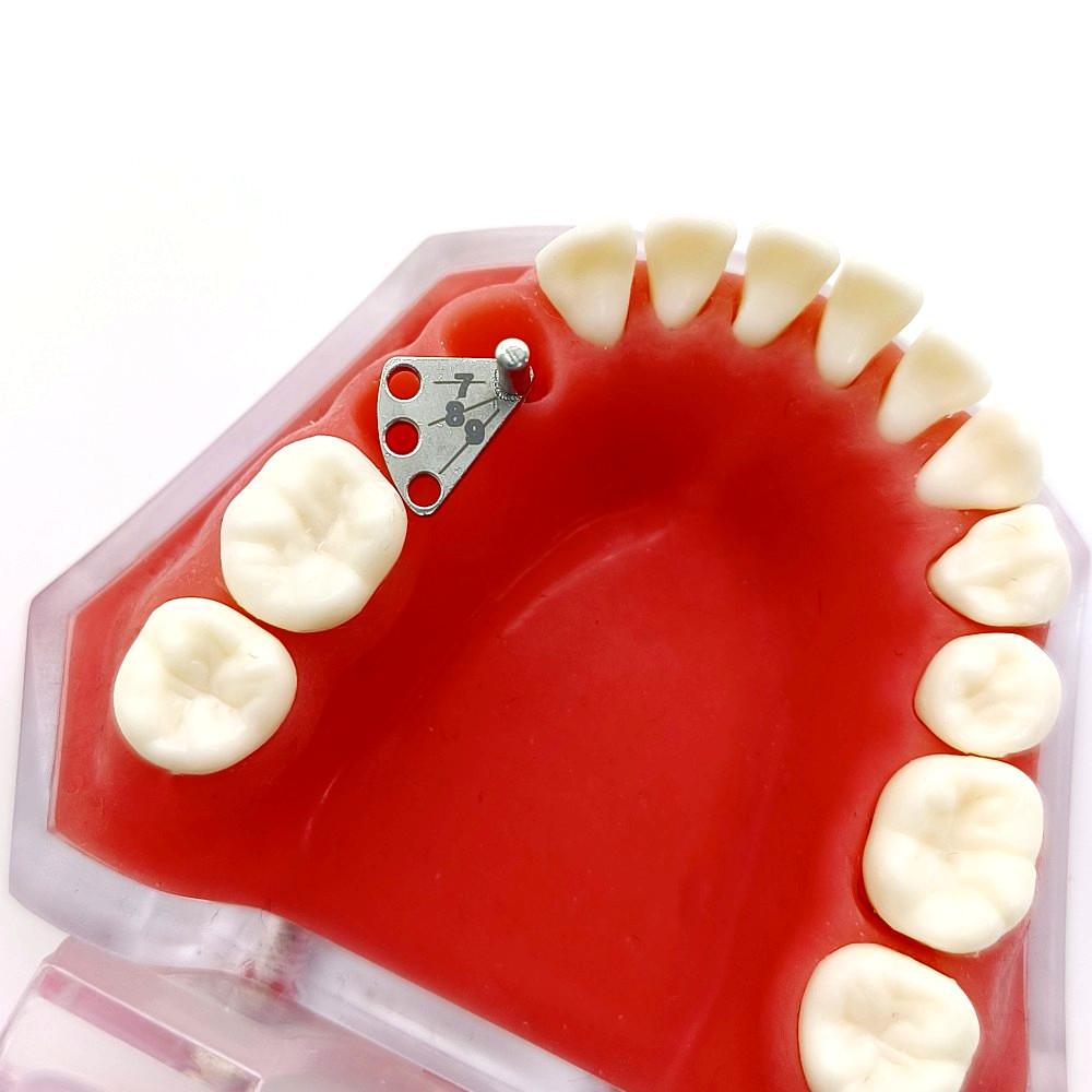 Зубной имплантат. Калибр с параллельными штифтами. Лакатор из нержавеющей стали. Направляющая для локации зубного имплантата. Локационная линейка.