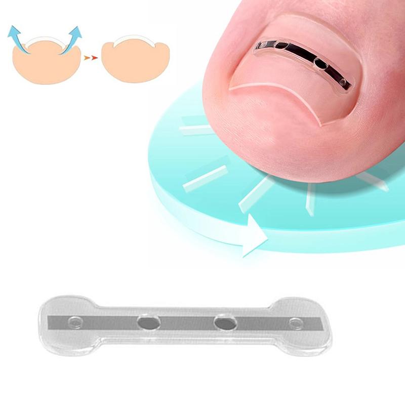 Инструмент для коррекции вросшего ногтя Эластичный пластырь для лечения вросшего ногтя Наклейка для выпрямления Зажим для скоб Инструмент для педикюра