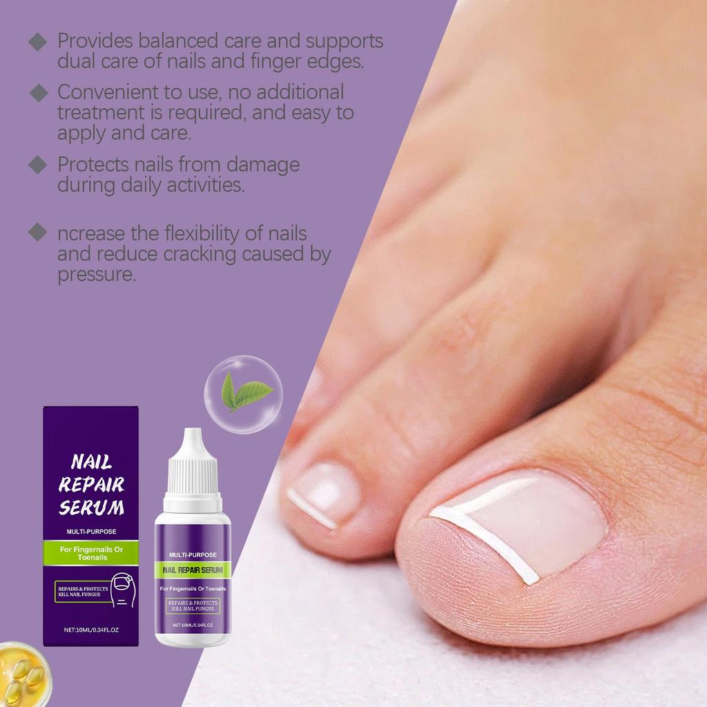 Nail Care Solution Deeply Nourishes Nails, Enhances Toughness, Reduces Breakage, Repairs Damage And Promotes Nail Growth.10ML