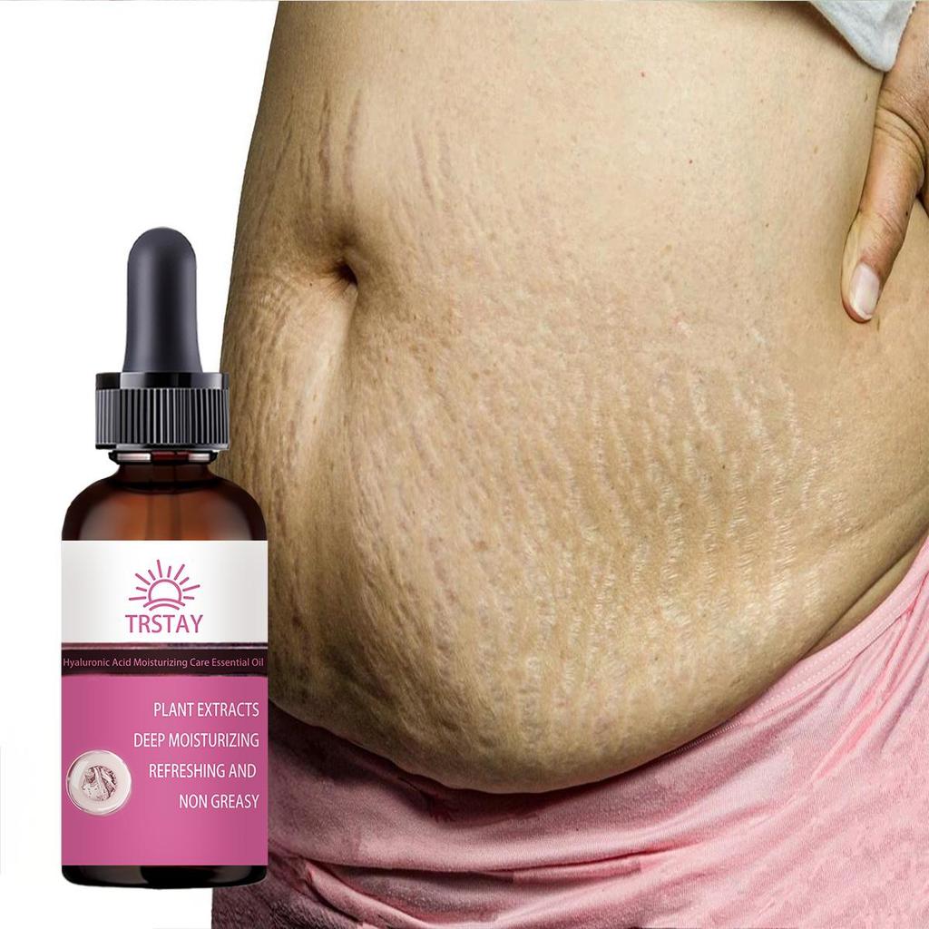 Pregnant Women Repair Belly Lines, Postpartum Repair Cream, Prevention Body Cream, Moisturize Skin , Remove Pregnancy Lines, Fat Lines, Face Cream