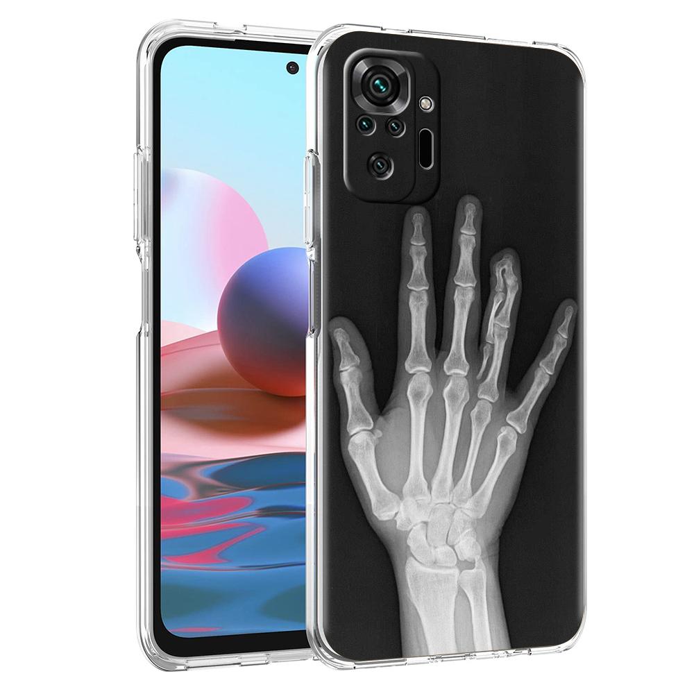 Прозрачный чехол для телефона для Redmi 14C 13C 10C 10 9 Note 13 12 11 K50 K40 Plus Pro 4G 5G Мягкий ТПУ чехол Осень Рентген Кости Руки