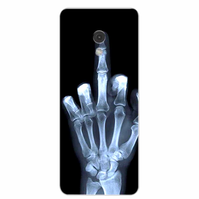For Nokia 235 4G 2024 Phone Case Cover Clear Edge Silicone Soft TPU Back Cover Cases For Nokia 215 4G 2024 Case 2.8" Coque Funda