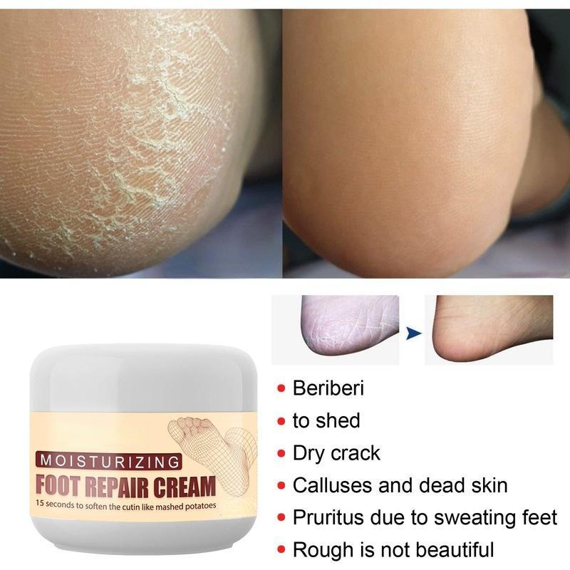 Foot Repair Cream Увлажняющий и восстанавливающий крем для ухода за ногами, шелушением пяток