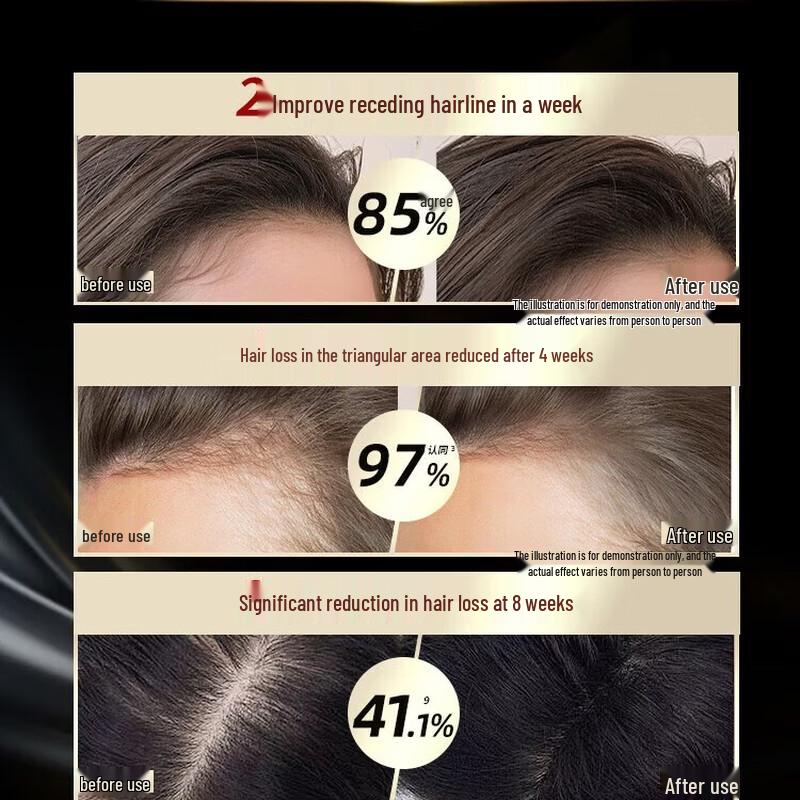 Schwarzkopf Шампунь против выпадения волос и для контроля жирности