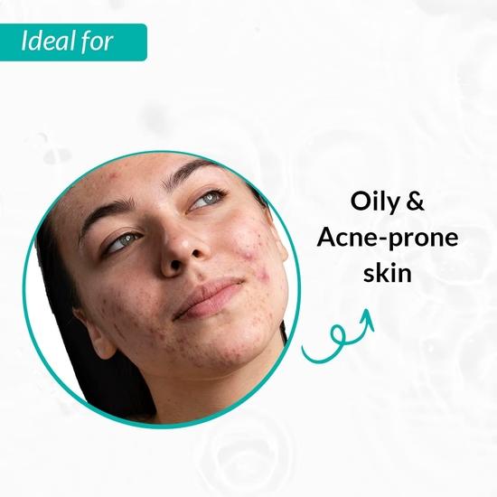 Fixderma Peelonate BHA очищающее средство для лица, отшелушивающее средство, средство для пилинга лица, очищает поры кожи, удаляет прыщи, нормализует жирность кожи, устраняет белые угри - 100 мл