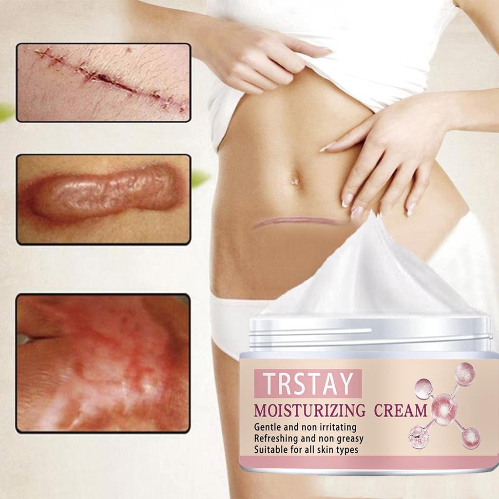 Сыворотка для удаления шрамов от прыщей, масло, эфирные масла, эссенция, гель, лечение растяжек, прыщи, пятна от прыщей, хирургические шрамы, ожоги