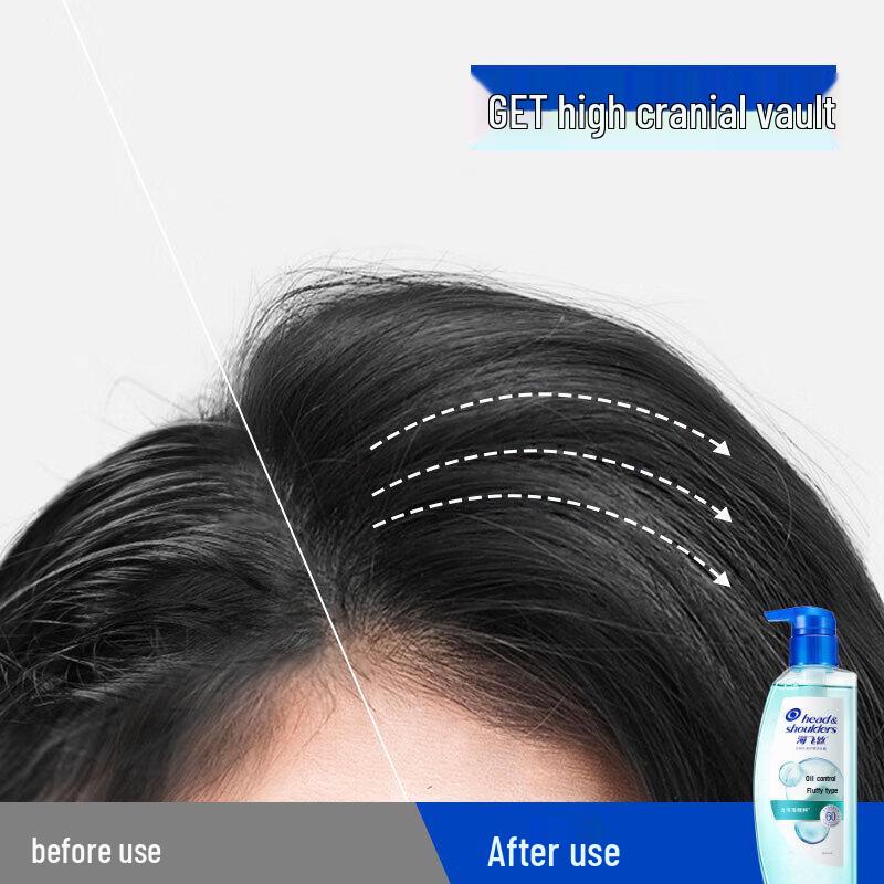 Head & Shoulders Oil Control Volumizing Anti-Dandruff Shampoo