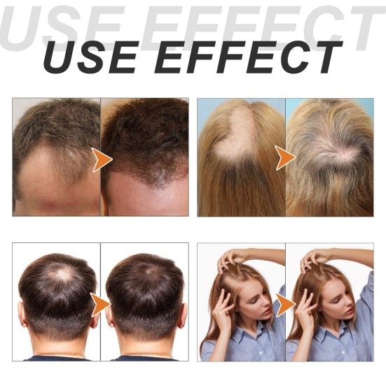 200 мл лук, биотин, розмарин, шампунь против выпадения волос, увлажняющий для мужчин и женщин, лечение облысения, уход за волосами, натуральный утолщающий шампунь для восстановления роста волос