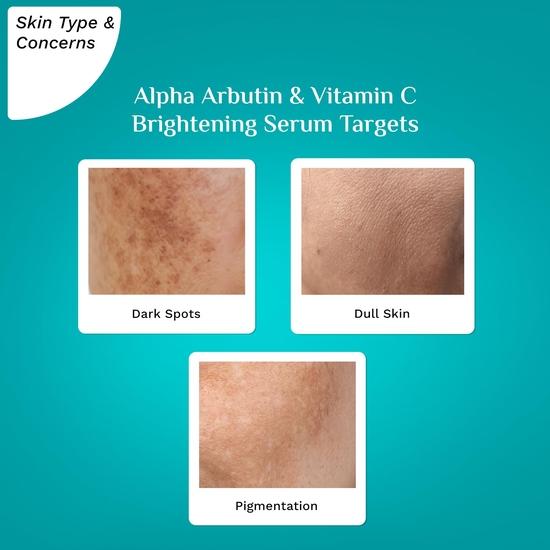 PILGRIM Korean 2% Alpha Arbutin & 3% Vitamin C Brightening Face Serum for Glowing Skin| Alpha Arbutin Face Serum| Vegan & Cruelty-free | 30ml