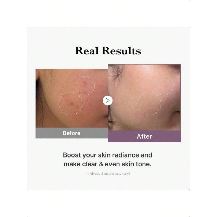 Medicube Age-R Glutathione Glow Milky Toner 140ml, Low-Irritation Double Layer Toner For Glass Glow Skin With Peptide, Radiance, Hydration