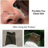 Vibrate   Face Clning Device Skin Scrubber Face Lifting Peeling Clner