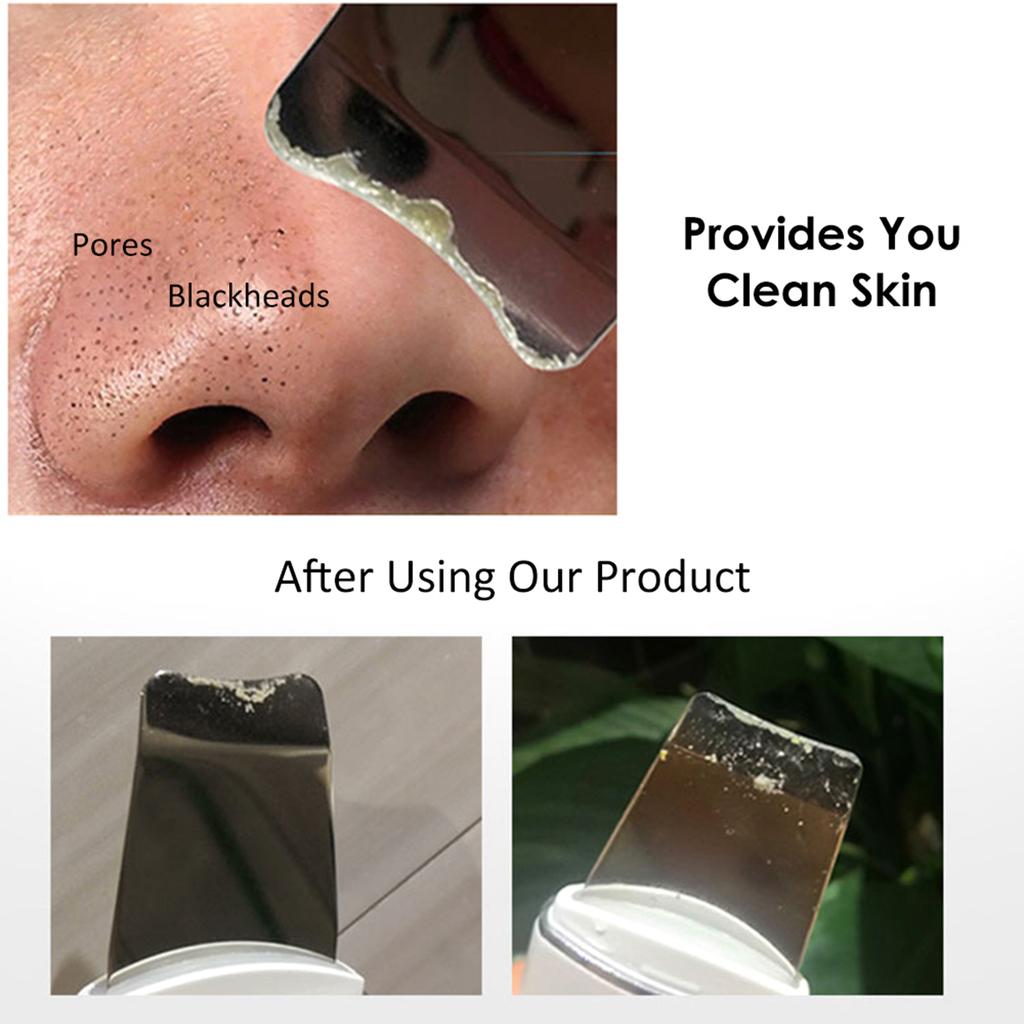 Vibrate   Face Clning Device Skin Scrubber Face Lifting Peeling Clner