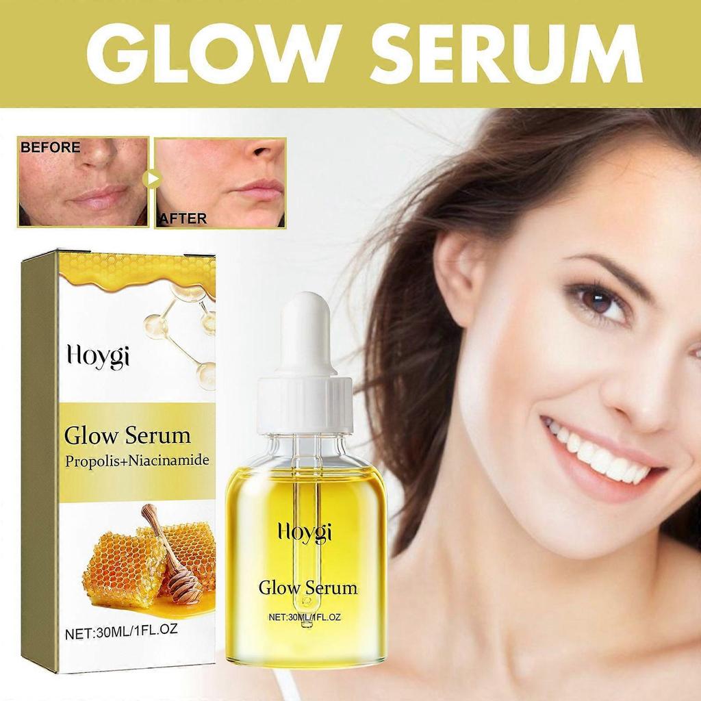 Limited time!!Hoygi Propolis Nicotinamide Essence Hydrates, Moisturizes, Whitens The Skin And Fades Facial Pigmentation And Fine Lines