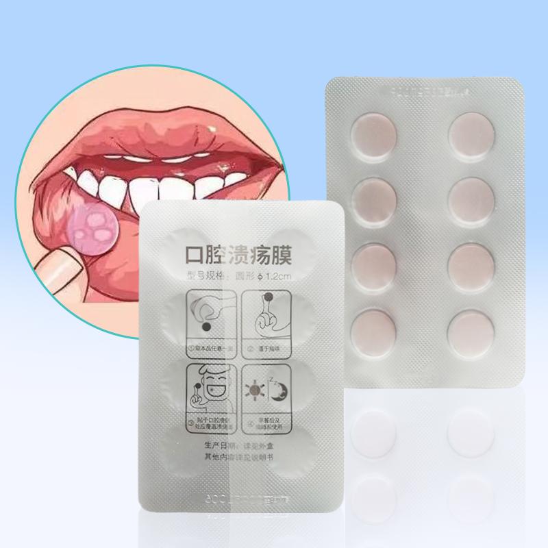 Патч для быстрого лечения язв во рту, повязка для ран полости рта при афтозном стоматите, быстрое облегчение боли, лекарство от афтозного стоматита, обезболивающее