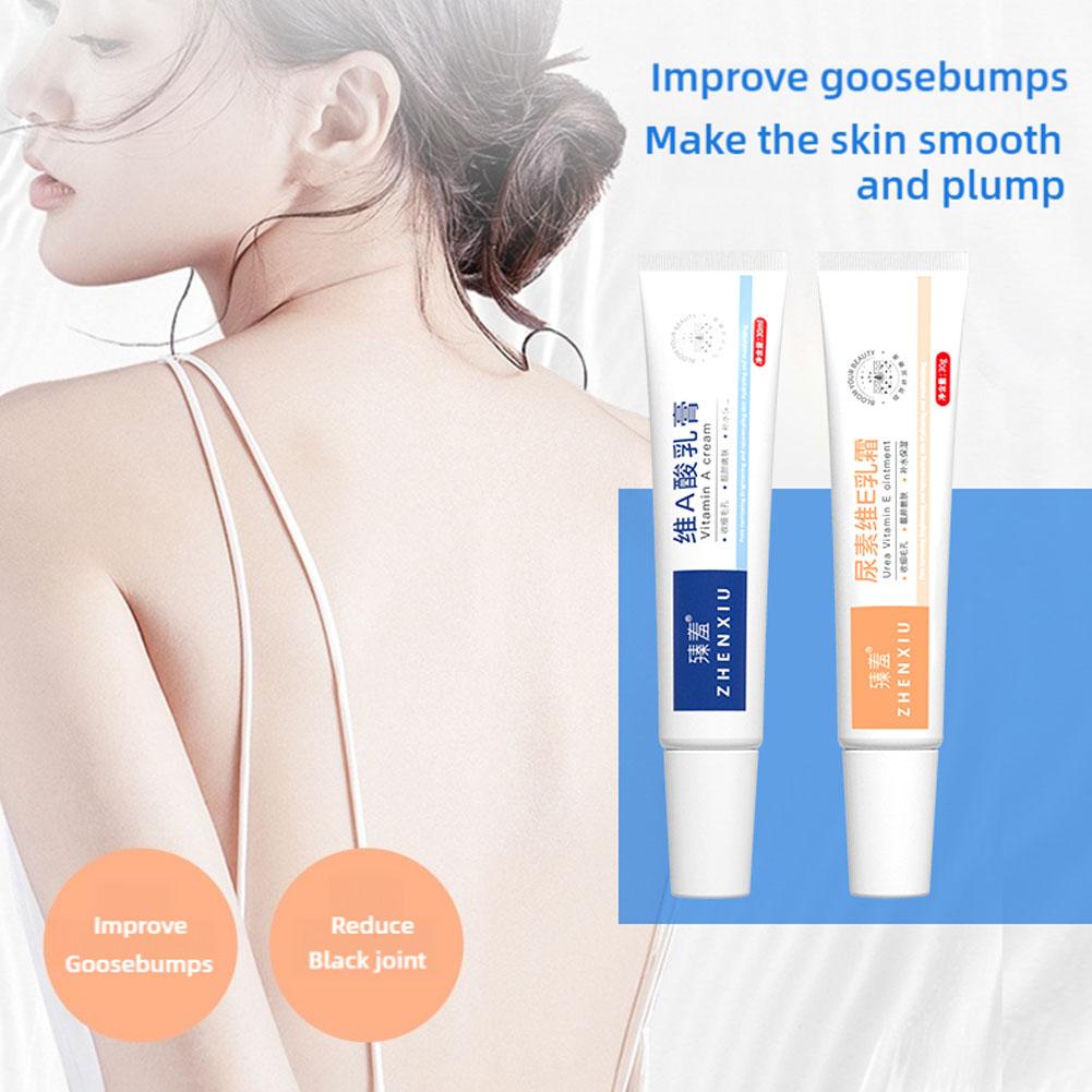 Крем для отбеливания тела Кератоз Фолликулярный Лечение Неровные Огрубевшие Ноги Курица Ремонт Уход Удаление F I0G2