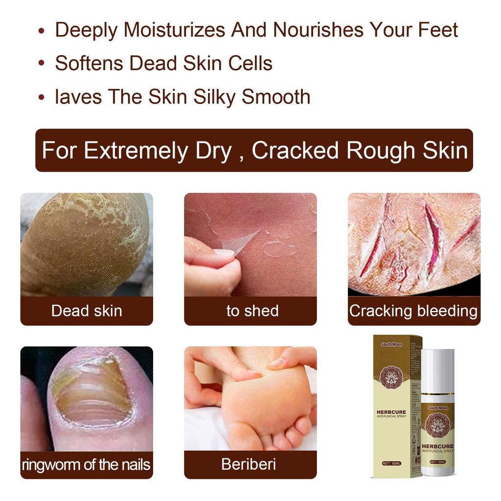 South Moon Herbal Foot Mist Foot Skin Moisturizer Hydration Anti-Cracking Skin Mild Conditioner