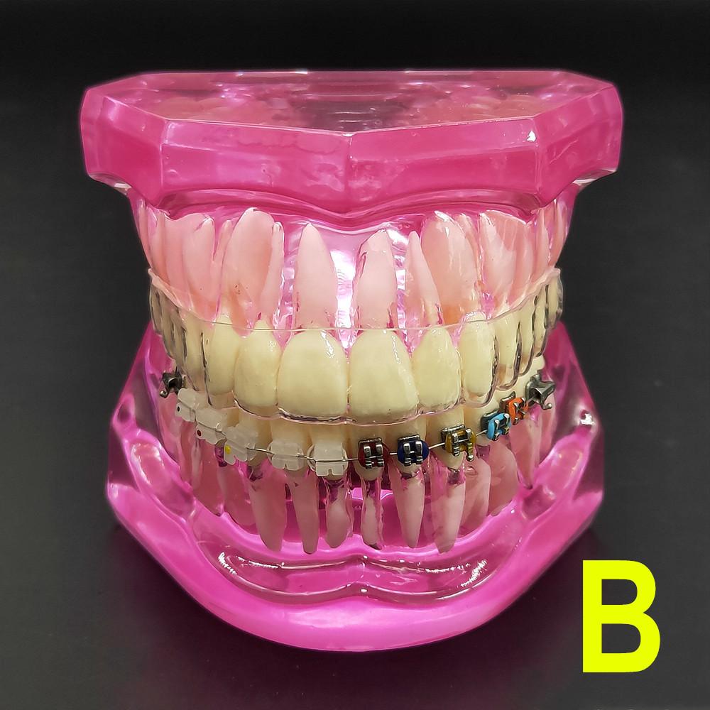 Модель зубного зуба Ортодонтическая модель для общения с пациентом Модель зубов для стоматологического исследования с невидимым прозрачным кронштейном Модели стоматолога