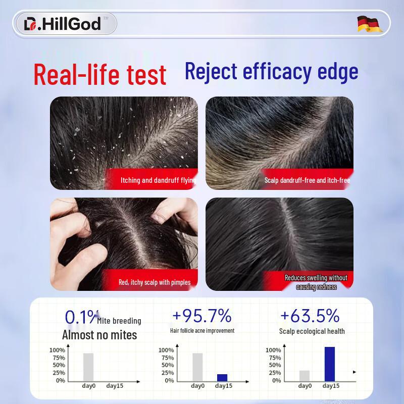 Лечебный шампунь с немецким дегтем доктора Хилла