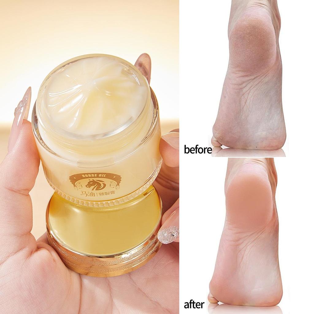 Самый продаваемый крем с лошадиным жиром: Увлажняющее и подтягивающее средство для рук и ног от сухости, трещин и морщин.