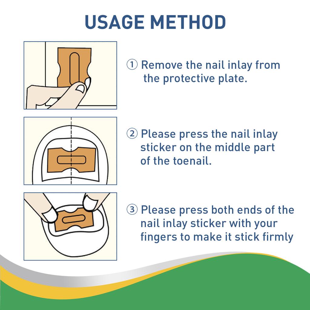 50 Pcs/Set Nail Ingrown Stickers Double-sided Adhesive Ingrown Toenail Correction Ingrown Toenail Correction Tool Elastic Patch Stickers