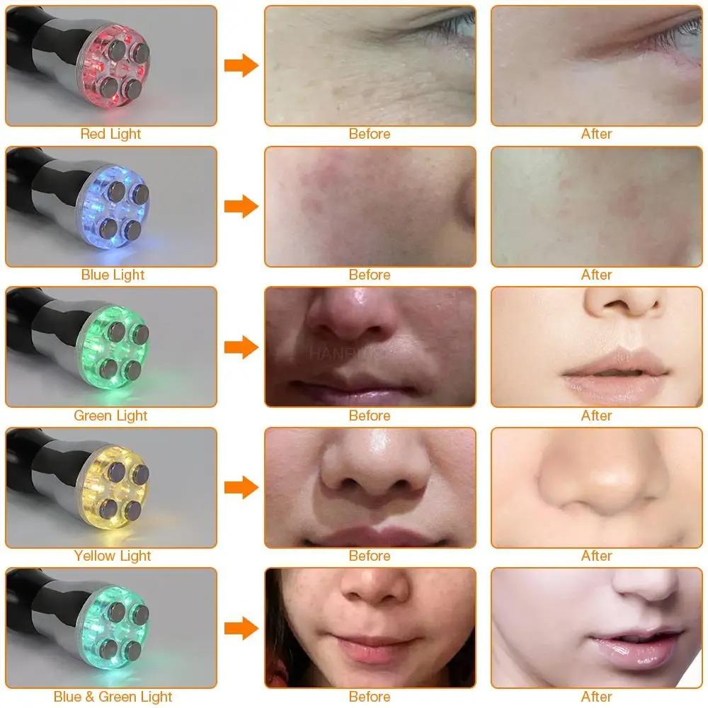 RF Радиочастотный массажер для лица, светодиодный фотонный мезотерапия для лица, электропорация, косметический аппарат, омоложение, лифтинг лица