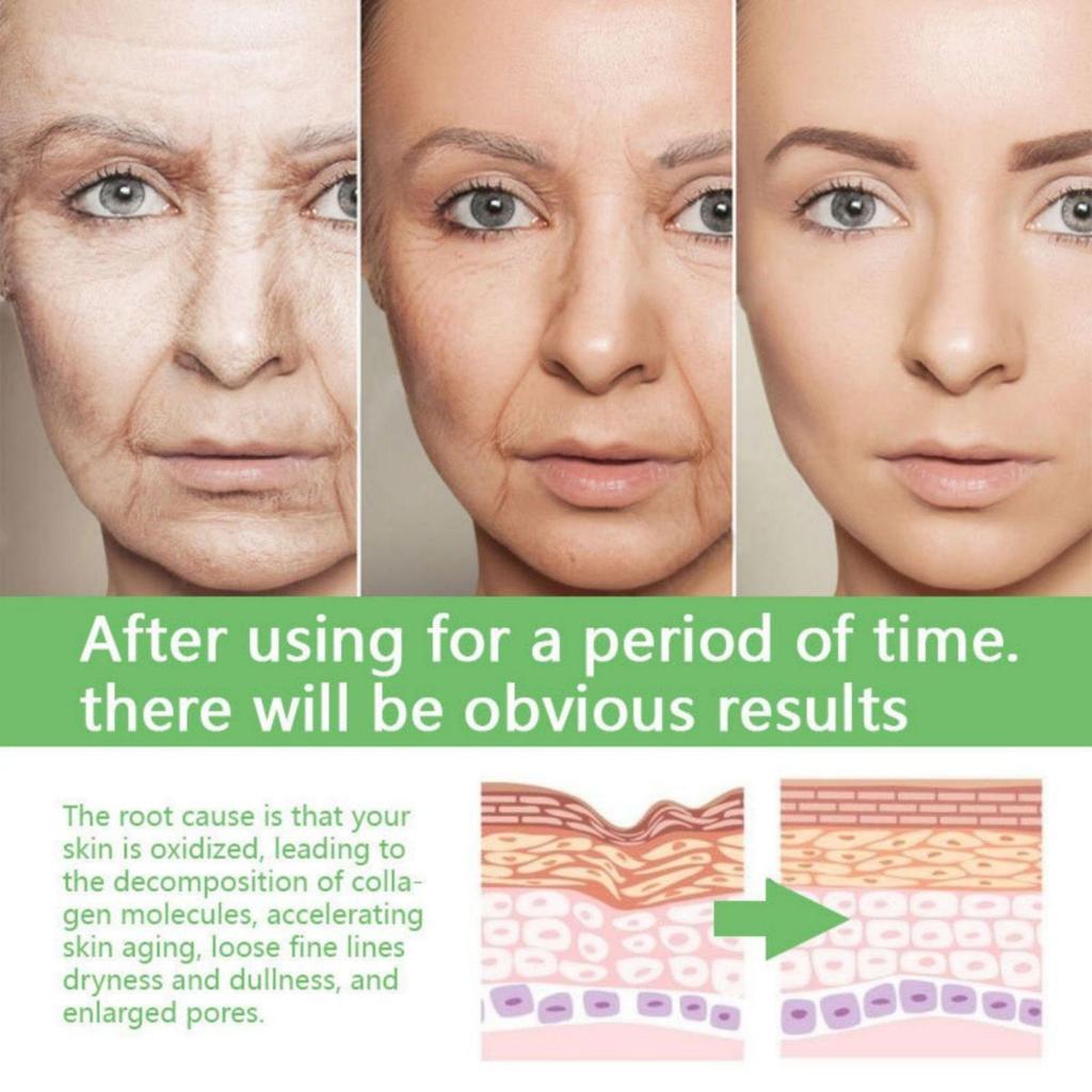 TRSTAY Витамин С для лица Крем для удаления пигментов и темных пятен Отбеливающий крем для лица Осветляющий уход за кожей Средства по уходу за кожей Красота Здоровье