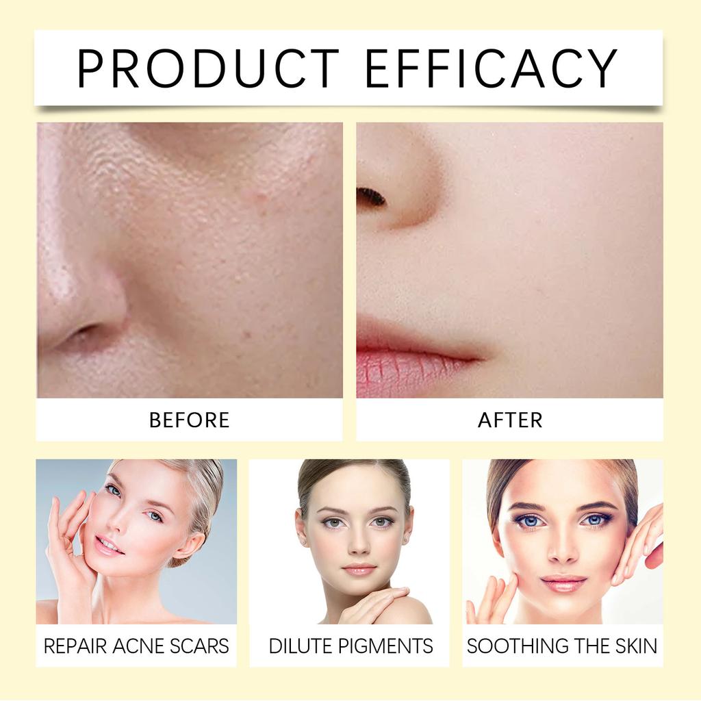 Nourishing Eye Cream Eye Care Firms The Eye Area, Deeply Nourishes, Effectively Relieves Dry Eyes, And Lastingly Moisturizes.