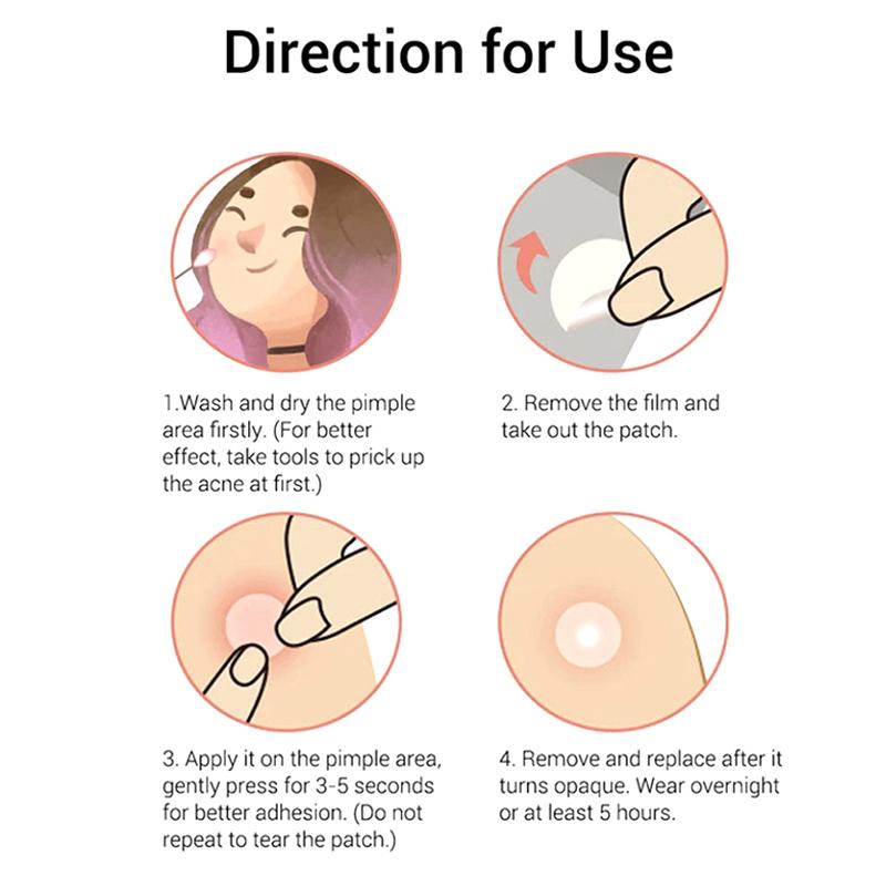96 шт. пластырь от прыщей Cat's Paw, средство для удаления прыщей, средство для устранения пятен, маска для лица, уход за кожей, скрытый прыщ
