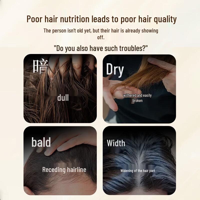 Bawang Anti-Hair Loss & Oil Control Shampoo