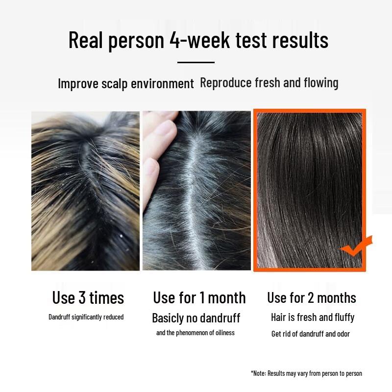 LK High Purity Botanical Anti-Dandruff Amino Acid Shampoo