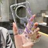 Чехол для телефона с изображением пары и розы для Honor 400 Lite 200 Pro 90 Smart 70 X7 Масляная живопись Прозрачный мягкий чехол Honor 400Pro