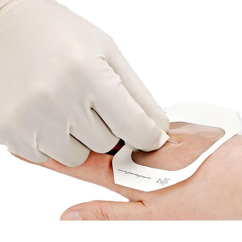 10 шт. прозрачная пленочная повязка водонепроницаемая пластырь для ран после инфузии постоянная игла фиксирующая паста