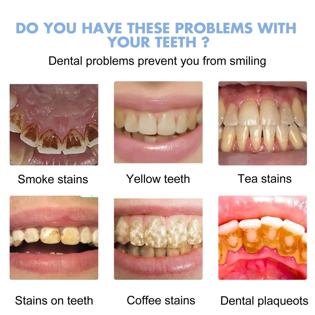 EELHOE Зубная паста для чистки зубов Гель для отбеливания зубов Глубокая чистящая пена Зубная паста удаляет пятна Свежее дыхание Инструменты для ухода за зубами 30 мл