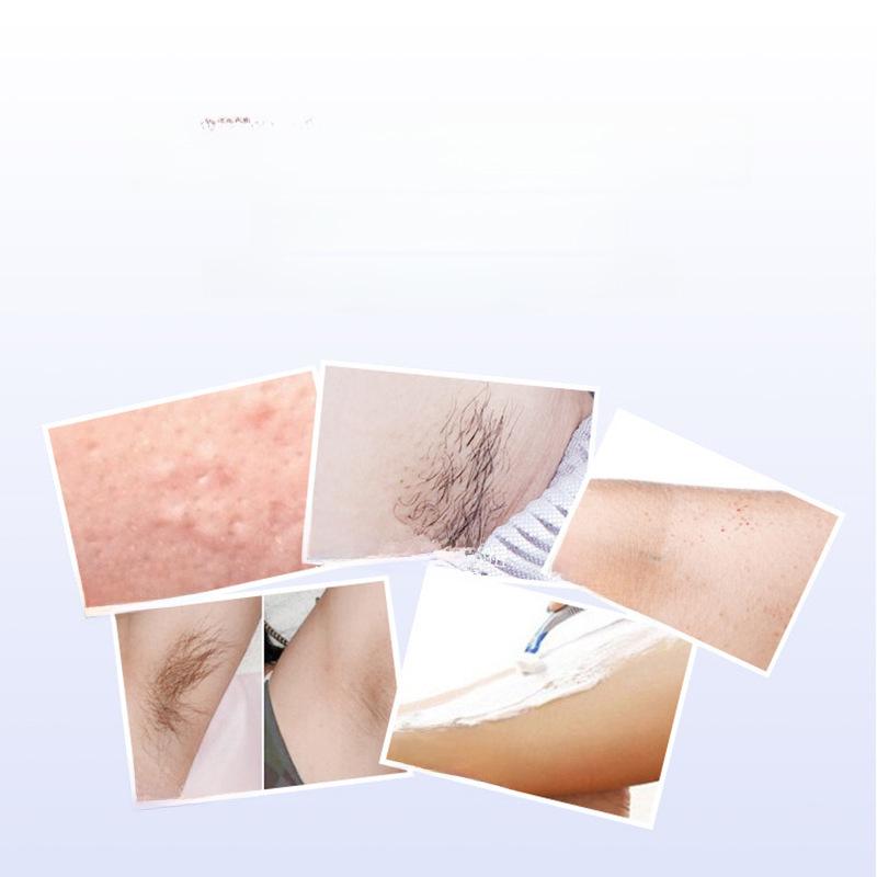 Многофункциональная электробритва 4-в-1 с зарядкой от USB для безболезненного удаления волос по всему телу