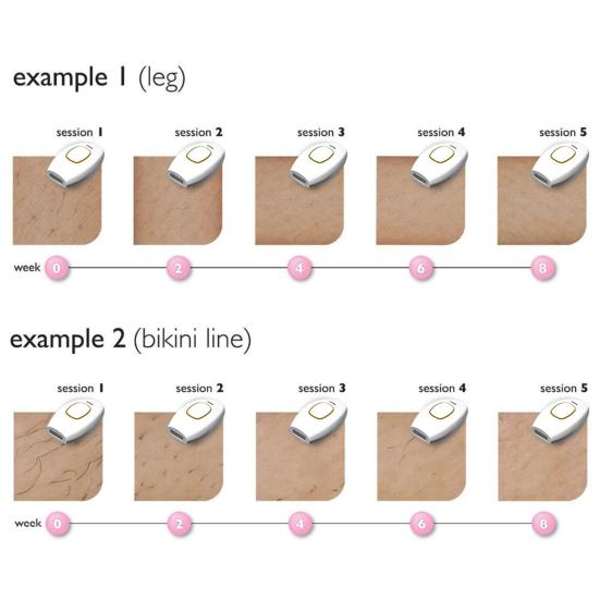 Yousheng Hair Removal Device Women Home Permanent Painless Electronic Hair Remover Full Body Face Arm Leg Bikini Line IPL Hair Removal Machine