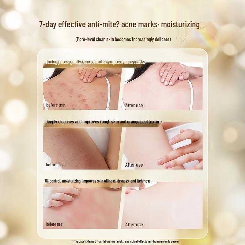 Han Zhixi Sulfur 3-in-1 Mite Removal Liquid Soap