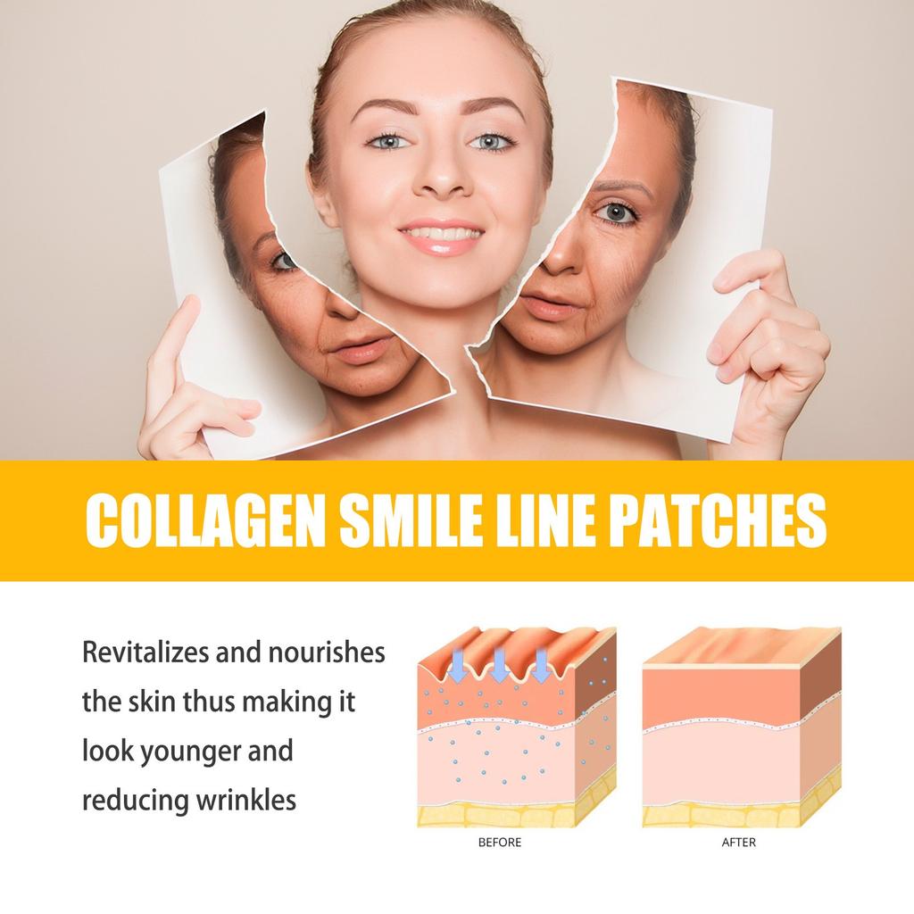 Collagen Smile Line Wrinkle Patches Facial Wrinkle Patches - Anti-wrinkle Facial Patches For Smoothing Smile Lines