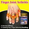 Облегчение артрита пальцев: Борется с ревматизмом и отеками