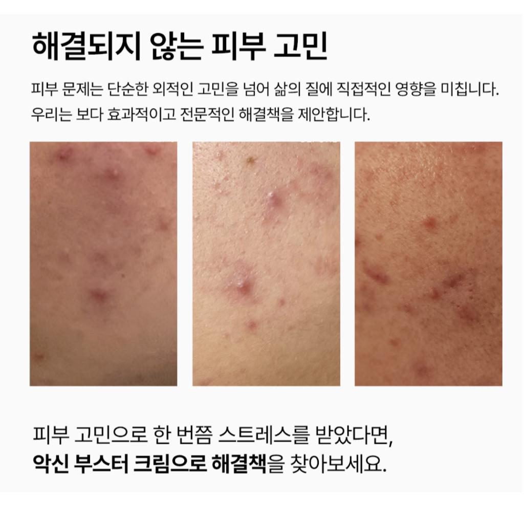 [Vemontes] AXCNE Бустер-крем 25мл