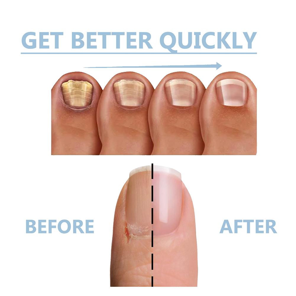 15 мл сыворотка для укрепления ногтей жидкость для восстановления ногтей для восстановления и укрепления ногтей