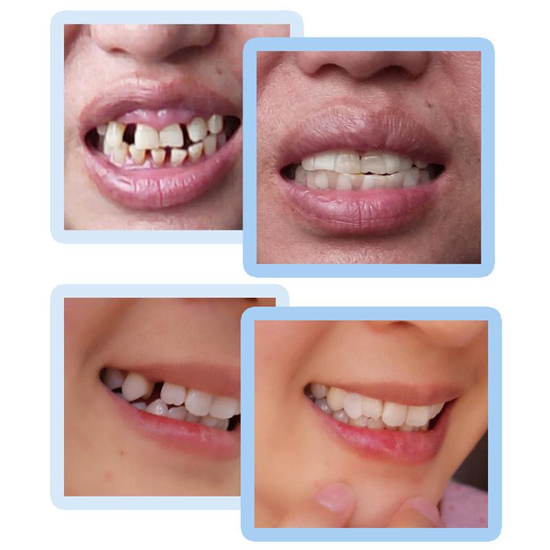 30Ml Tooth Repair Kit Teeth Gap False Teeth Solid Glue Adhesive Beauty Tool