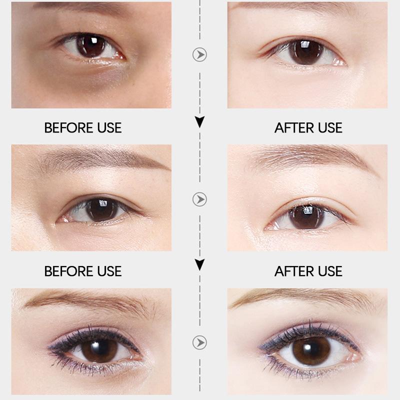 Пептидный крем для глаз против морщин, удаление темных кругов, сужение пор, увлажняющий, отбеливающий, уход за кожей вокруг глаз