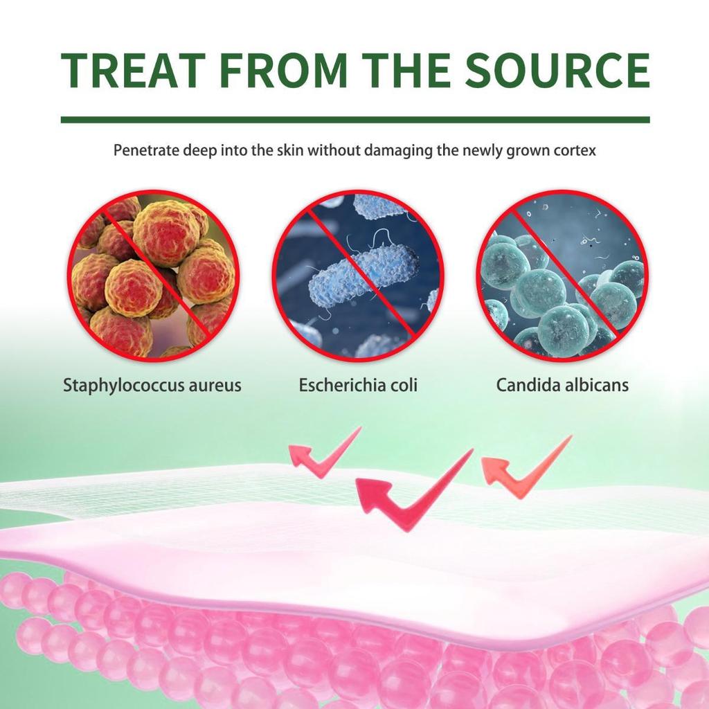 Repair and Nourish Your Feet with Our Foot Mask for Cracked Heels and Dry Skin